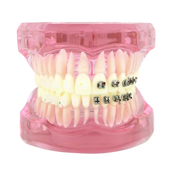 Dantų Ortodontinis Dantų Studijų Praktikos Modelį su Metalo Keramikos Laikiklis Petnešos M3003